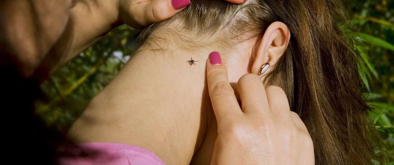 Що робити, якщо вас укусив кліщ