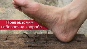 Що потрібно знати, коли працюєте в саду та на огороді